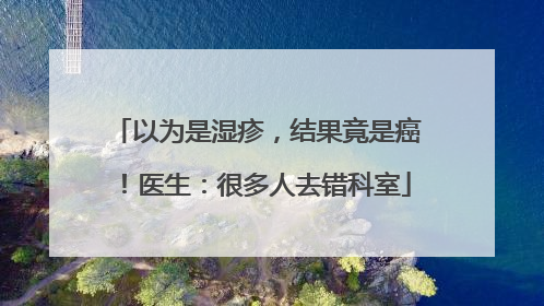 以为是湿疹，结果竟是癌！医生：很多人去错科室